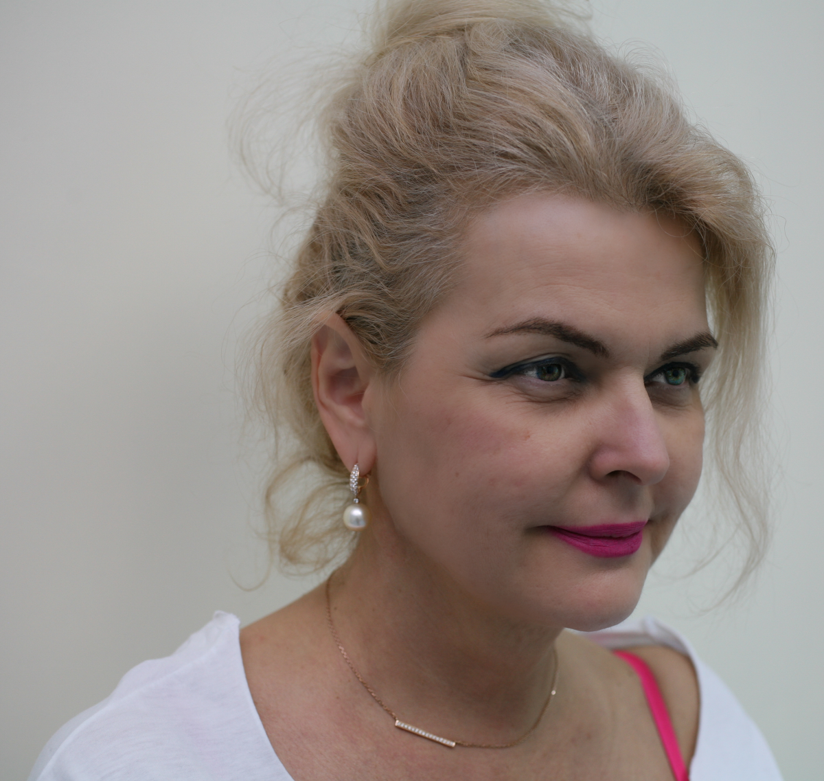 4 weeks after eyelid surgery with Mr Ardeshir Vahidi